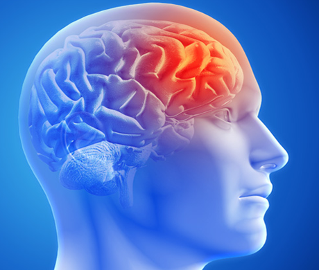 Prevención de Migrañas y Mejora de la Circulación